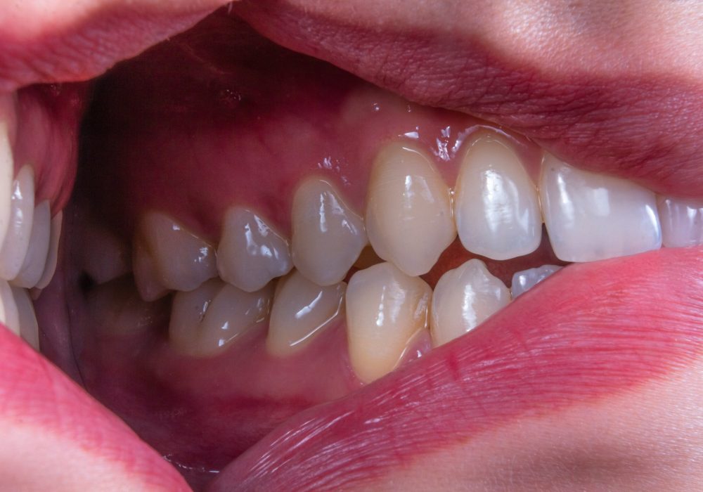 ozkan-guner-8xony1iBeaI-unsplash