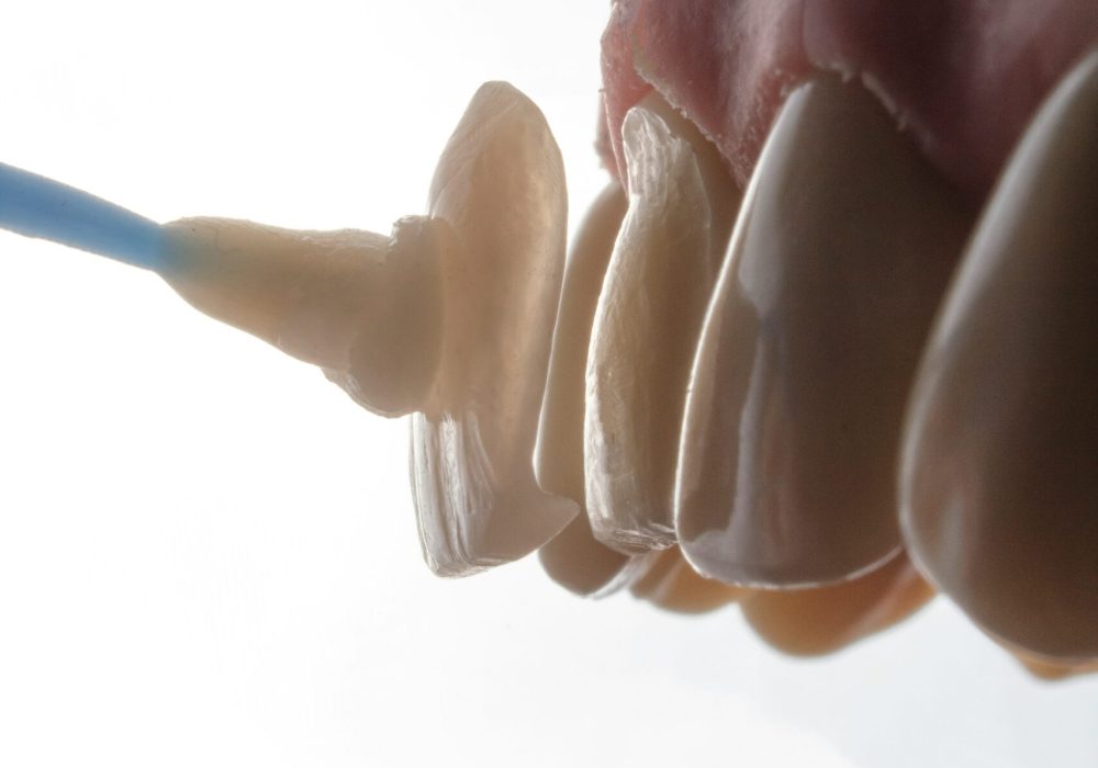 ozkan-guner-rQVrZdAHXQQ-unsplash